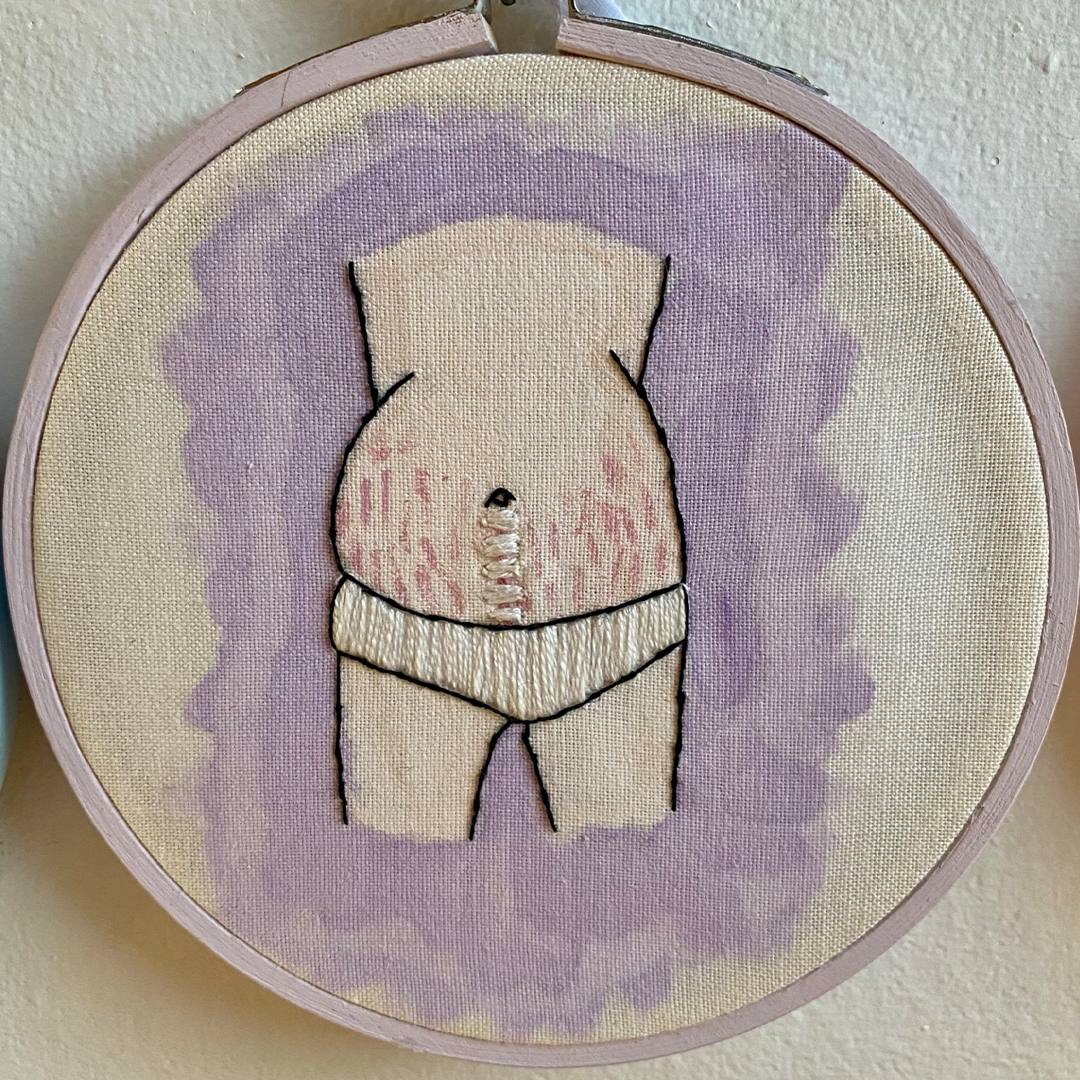 an embroidery of c section scar